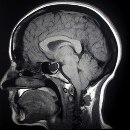 https://www.wetenschapsschool.nl/chapter/radioactiviteit/MRI2.png