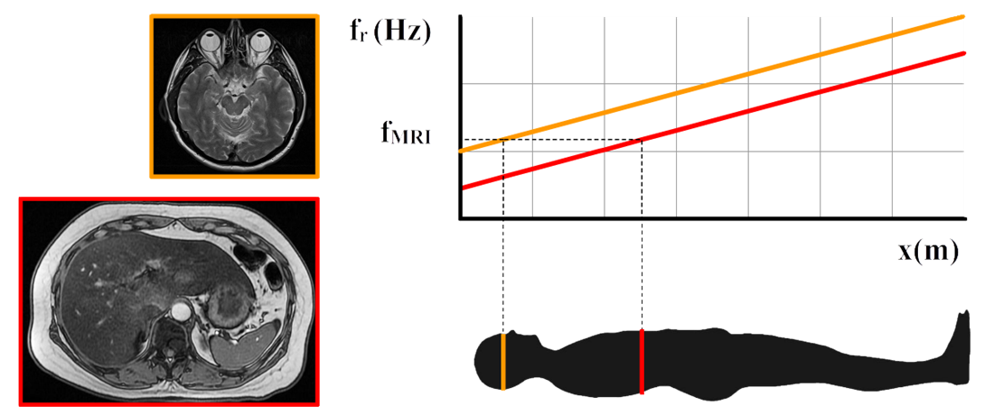 http://wetenschapsschool.nl/chapter/radioactiviteit/MRI6.png